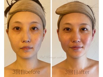 パル コルギサロン(Pal. Korugi salon)/コルギビフォーアフター