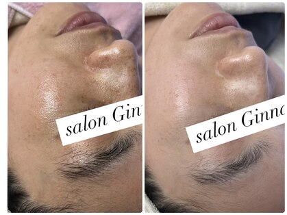 ジーナ(Ginna)の写真