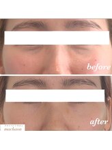 マカオン(machaon)/【小顔リフト】小顔マッサージ