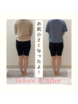 スタイルラボ高松/産後の骨盤矯正の効果♪
