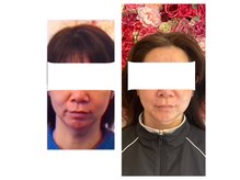 サロン ド ルポゼ(Salon de Reposer)の雰囲気（人気の小顔メニューでお客様に合わせたパックで美肌に！）