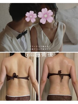 アムスパ(Aum Spa)/ブライダル