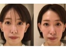 マーノ 福岡 薬院(mano)の雰囲気(小顔矯正10回/3ヶ月【福岡/薬院/平尾/小顔矯正/筋膜リリース】)