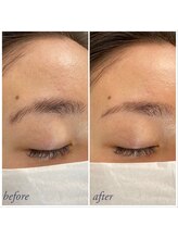 ティアル 赤坂(tiarl)/本格シェービング