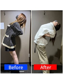 ナオル整体 仙台院(NAORU整体)/20代女性 慢性腰痛を良くしたい