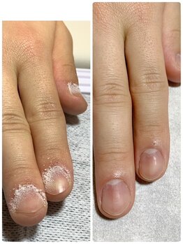 ウェルネスマルカ(wellness MARCA)/ ロシアンビットハンドケア