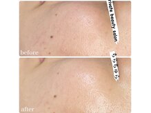 ちらちゅら/クリスティーナ【アンストレス】