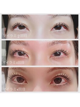 ベルフルール 西18丁目店/マイラミネーション