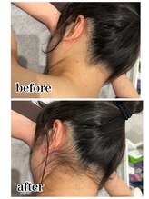 ケースタイル(k.style)/うなじbefore after