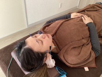 ハリファ鍼灸院 横浜関内院(HariFa鍼灸院)/美容施術