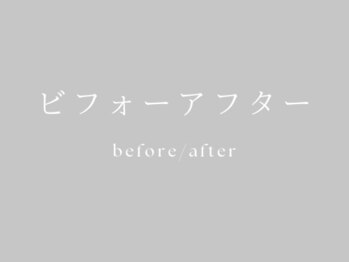 ラ フォルポ 恵比寿(La forepos)/恵比寿ハーブピーリングエステ