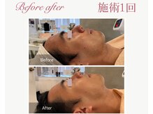 パルタージュ 三宮(Partage)/ハーブトリートメント