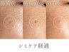 【シミケアのお試しに◎】お任せ☆シミ集中コース(60分)