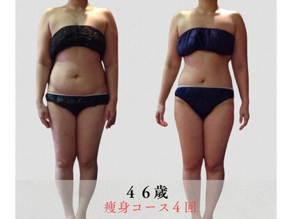 サンテボーテ(Sante Beaute)の写真