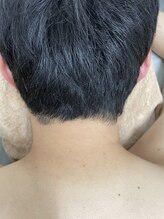 ナノハナ/鹿沼市の全身脱毛のナノハナ