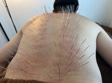 けんたろう鍼灸院/肩こり　腰痛