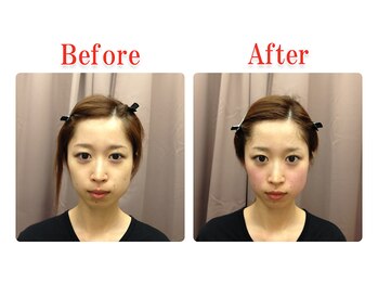 ビューティースリム タニダ/頭蓋骨&小顔&顎関節矯正