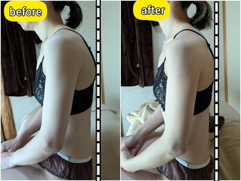 スノードロップ(snowdrop)/リンパマッサージで巻き肩改善