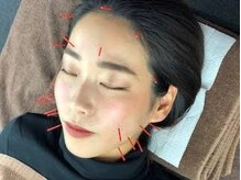 はりきゅう整骨院 健志の雰囲気（西中島南方で唯一の美容鍼に特化した鍼灸整骨院◎初心者大歓迎♪）