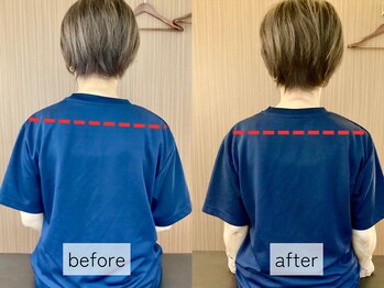 ゼン骨盤整体院(ZEN骨盤整体院)/【40代女性】首の痛み・首肩こり