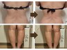 【コリ/むくみ★上半身or下半身】脂肪燃焼ラジオ波×筋膜リリース70分