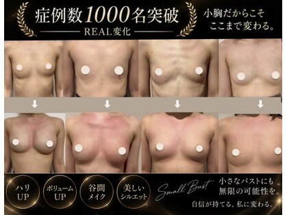 アーレ 福岡天神店(ARE)の写真