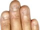 ネイルアンドビューティーサロン ブルーム(nail&beautysalon BLOOM)の写真/深爪・小さい爪などのお悩みや、爪のトラブルはお任せください☆自爪を育てながら理想の指先へ仕上げます☆