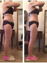 ココクレール(Coco Clair)/痩身　before →after 