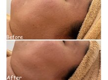 アイティス(Salon Its)/【Before &After】