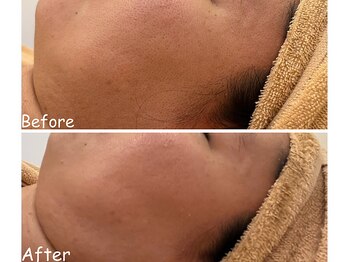 アイティス(Salon Its)/【Before &After】