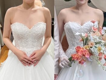 オードリリー(eau de Lily)の写真/【結婚式目前の方も◎】360°どこから見ても美しい◇オールハンドのブライダルエステで特別な1日を…♪