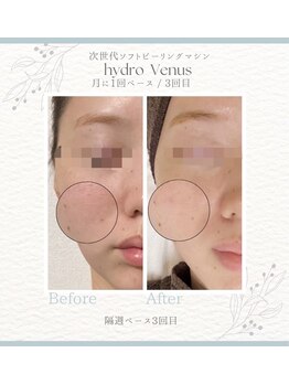 プティリッシュ(Petit Rishe)/ハイドロヴィーナス