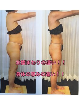 ボディエステティック アクアオーラ 富山店/おなかに注目！