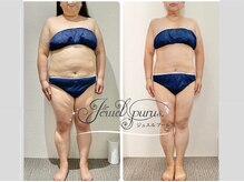 ジュエルプールス 天神店(Jewelpurus.)/体重だけではない美しい変化