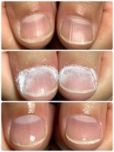 ウェルネスマルカ(wellness MARCA)/ ロシアンビットハンドケア