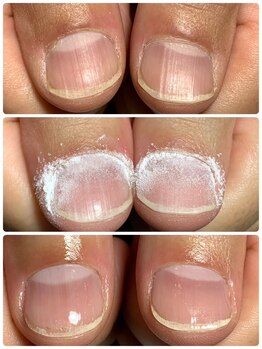 ウェルネスマルカ(wellness MARCA)/ ロシアンビットハンドケア