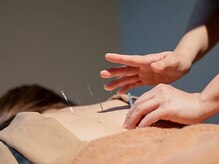 カラダキュア 東京銀座/鍼施術