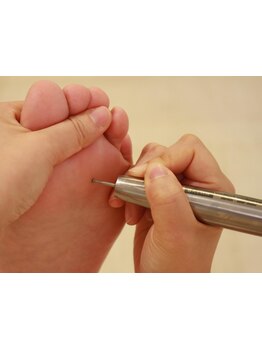 角質ケアができるサロン