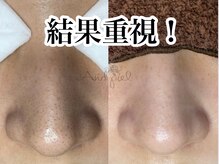アンドピエル(AndPiel)の雰囲気（結果重視のサロンケア！後悔させません。）