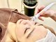 レイビューティサロン(Lei beauty salon)の写真/毛穴、ニキビにお悩みの方に！憧れの毛穴レス肌へ★【過熱水蒸気＋スクライバー＋毛穴洗浄】¥5980