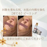 オーエーディ(oad)