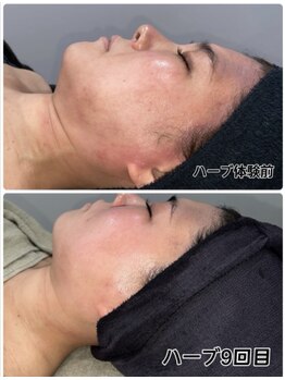 ナチュラリー(Naturally)/エステ/リラク/狭山ヶ丘/所