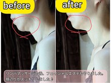 スノードロップ(snowdrop)/小顔マッサージで顎ラインが！