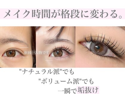 ワイズビューティ 梅田店(y’s beauty)の写真