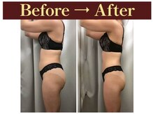 クオレ(CUORE)/ビフォーアフター