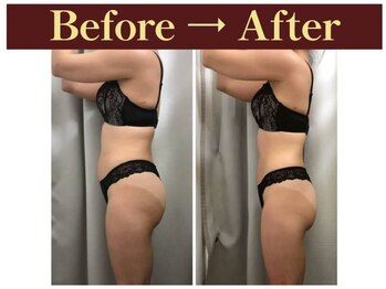 クオレ(CUORE)/ビフォーアフター