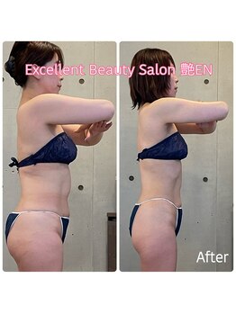 エクセレントビューティーサロン 艶(EN)/サブスク8.5ＫＧ減量