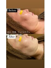 フェルヴィータ(Felvita)/