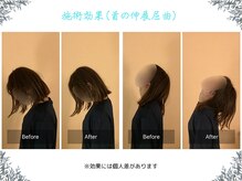 ボディ リセット アンド デザイン(Body Reset & Design)/【施術例】ビフォーアフター