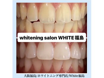 ホワイトニングサロン ホワイト(WHITE)/セルフホワイトニング/大阪/福島